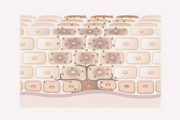 Image of an illustration of dark spots on the skin layers